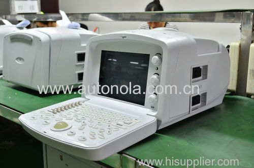 Digital Portable human Ultrasound scanner