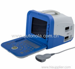 Digital Portable Human Ultrasound Scanner with factory cheap price