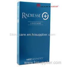 RADIESSE INJECTION FOR SALE