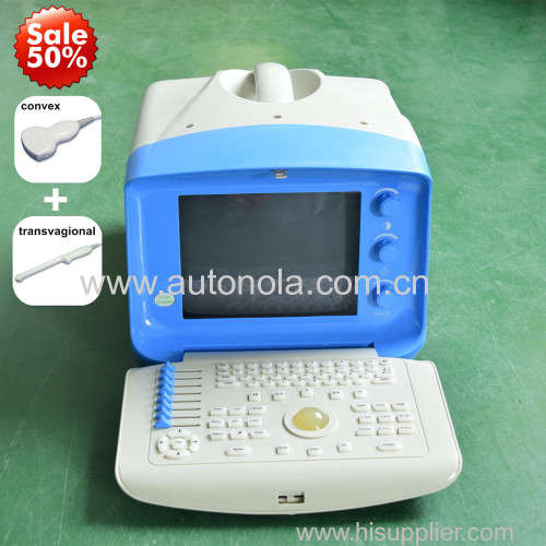 Portable B mode ultrasound machine and ultrasound scanner