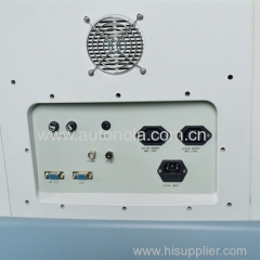 15 Inch LCD Digital Human Trolley Ultrasound Scanner HD image Multiple Function Seletion