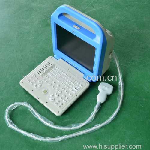 China manufacturer laptop ultrasound scanner