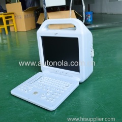 Autonola Laptop Ultrasound scanner Portable doppler Ultrasound with CE/ISO