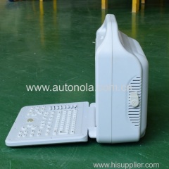 Special promotion Autonola Laptop Medical Ultrasound with CE approved ultrasound Doppler