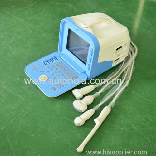 CE ISO ultrasound machine portable