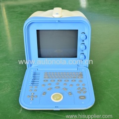 China portable ultrasound machine price new ultrasound scan imaging function with 18 months of Warranty