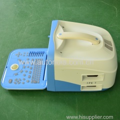 China portable ultrasound machine price new ultrasound scan imaging function with 18 months of Warranty