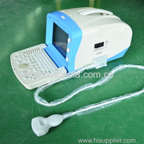 Factory price Portable ultrasound Portable Ultrasound Probe for sale