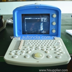 Factory price Portable ultrasound Portable Ultrasound Probe for sale