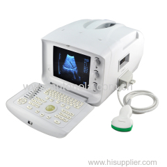 Portable Human Ultrasound Scanner Machine With First rate Attractive And Reasonable Price