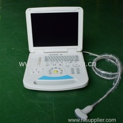 Full-digital Cheap Notebook Color Doppler System Convex Linear MicroConvex Transvaginal Probe