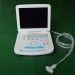 Notebook Human Color Doppler System