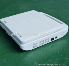 New Coming Full-digital High Quality Notebook Human Color Doppler System