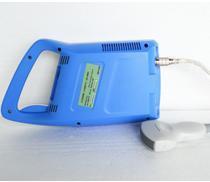 Full Digital Palm Ultrasound Scanner Good quality Accurate measurement Probe automatic identification for human