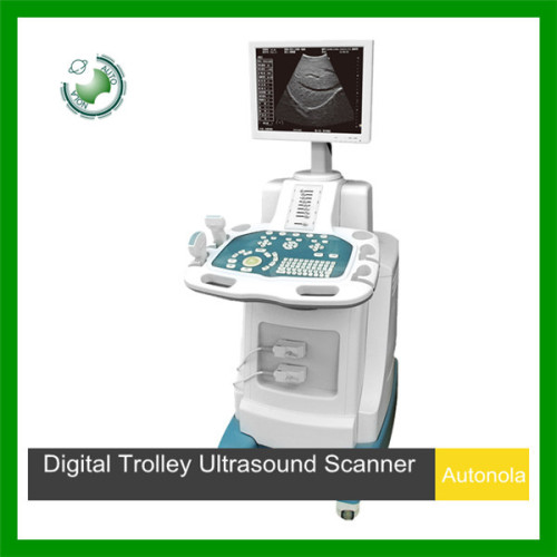 2D Digital Trolley Ultrasound Scanner