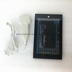 New arrival usb linear ultrasound probe for laptop in clinics emergency and outdoor