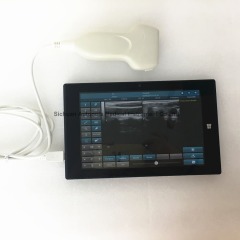 New arrival usb linear ultrasound probe for laptop in clinics emergency and outdoor