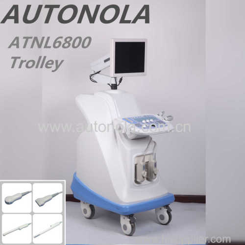 Cardiology ultrasound Trolley color doppler