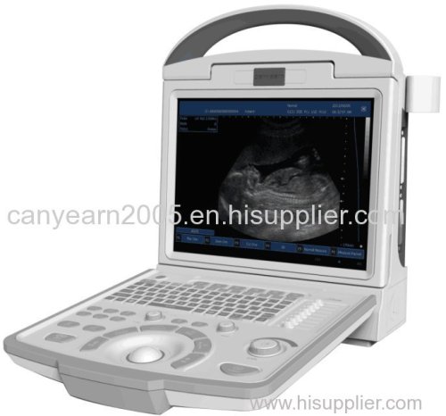 Canyearn Full Digital Portable Ultrasonic Diagnostic System Black and White Ultrasound Scanner