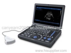 Canyearn Full Digital Laptop Ultrasonic Diagnostic System