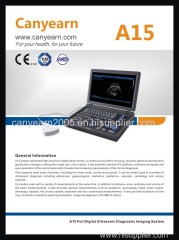 Canyearn Full Digital Laptop Ultrasonic Diagnostic System