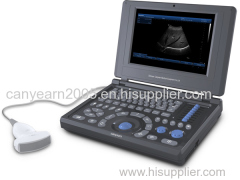 Canyearn Full Digital Laptop Ultrasonic Diagnostic System
