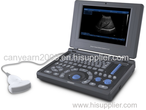 Canyearn A10 Full Digital Laptop Ultrasonic Diagnostic System