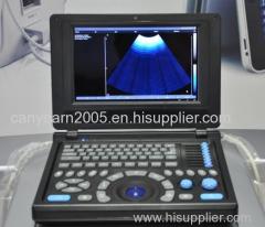 Canyearn Full Digital Laptop Ultrasonic Diagnostic System