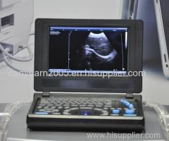 Canyearn Full Digital Laptop Ultrasonic Diagnostic System