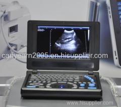 Canyearn Full Digital Laptop Ultrasonic Diagnostic System