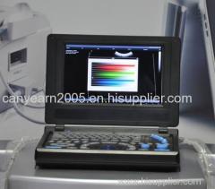 Canyearn Full Digital Laptop Ultrasonic Diagnostic System