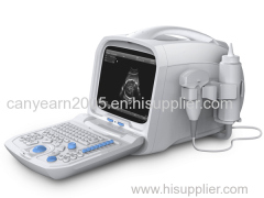 Canyearn Full Digital Portable Ultrasonic Diagnostic System