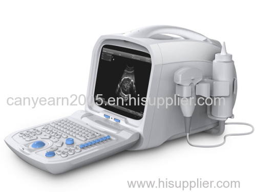 Canyearn A60 Full Digital Portable Ultrasonic Diagnostic System