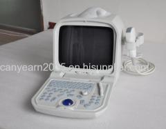 Canyearn Full Digital Portable Ultrasonic Diagnostic System