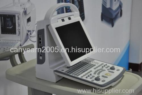 Canyearn Full Digital Portable Ultrasonic Diagnostic System Color Doppler Ultrasound Scanner