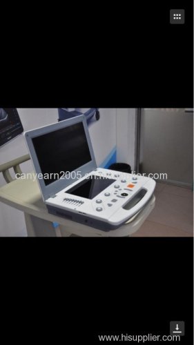Canyearn Full Digital Portable Ultrasonic Diagnostic System Color Doppler Ultrasound Scanner with Touch Screen