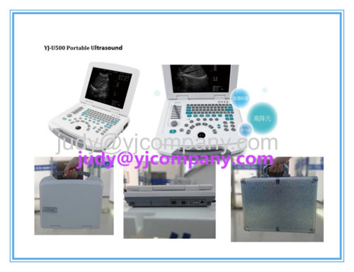 Full Digital Laptop Notebook Ultrasound Machine Scanner with battery