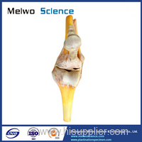 Human knee joint plastinated specimen for medical teaching