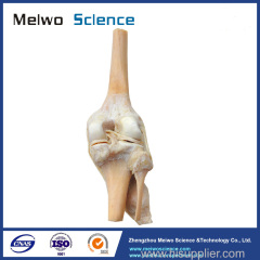 Human knee joint plastinated specimen for medical teaching