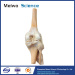 Human knee joint plastinated specimen for medical teaching