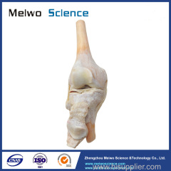 Human knee joint plastinated specimen for medical teaching