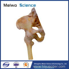 Medical Ligaments of Pelvis Plastination Specimen for Teaching