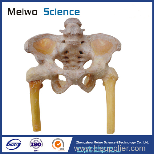 Male pelvis and hip joints ligaments plastinated specimen