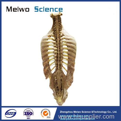 Human vertebral column plastinated specimen for medical students