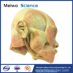 Superficial muscle of masticatory specimen for medical university