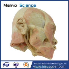 Superficial muscle of masticatory specimen for medical university