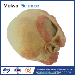 Superficial muscle of masticatory specimen for medical university