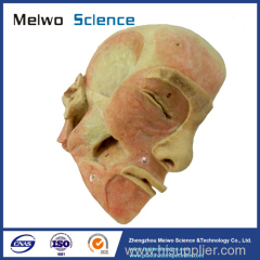 Superficial muscle of masticatory specimen for medical university