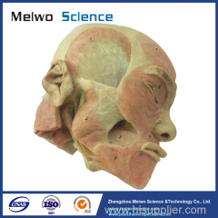 Superficial muscle of masticatory specimen for medical university