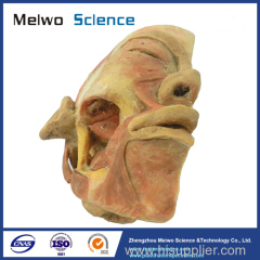 Deep muscle of masticatory plastinated specimen